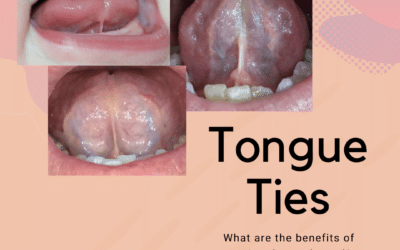 Frenectomies and Tie Releases