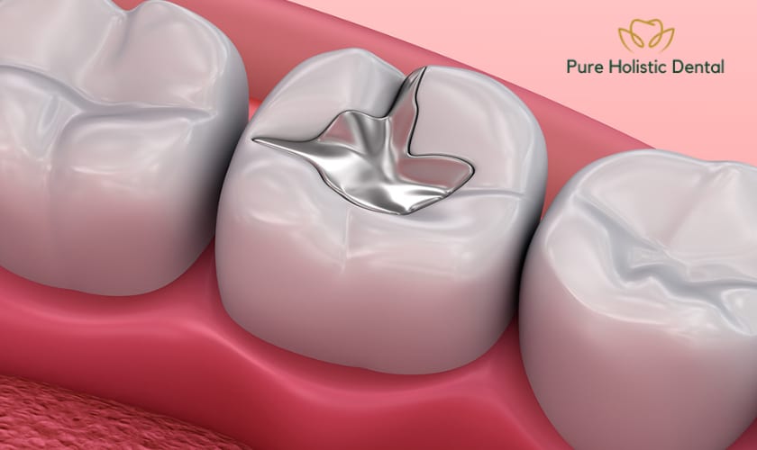 Why Are Mercury Fillings Harmful?