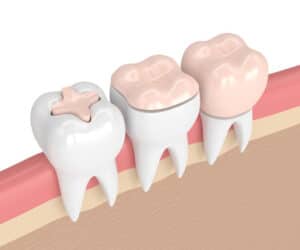 Biomimetic Dentistry