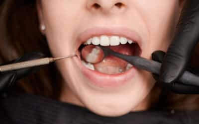 Alarming Findings on Mercury Dental Amalgam