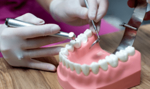 mercury-free alternative in dental fillings