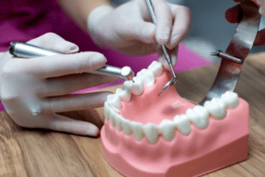 advantages of non-metal crowns