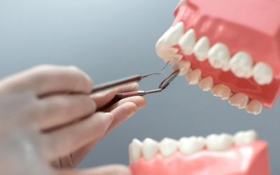 Root Canal Alternative Treatments for Saving Teeth