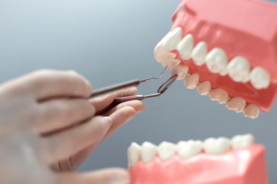 root canal alternative treatments for saving teeth