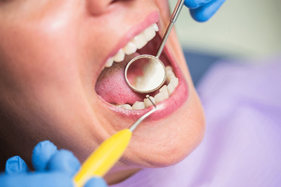 The Dangers of Mercury Fillings: How Mercury Free Dentistry Can Help