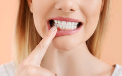 What Causes Gum Disease? Top Factors You Must Be Familiar With