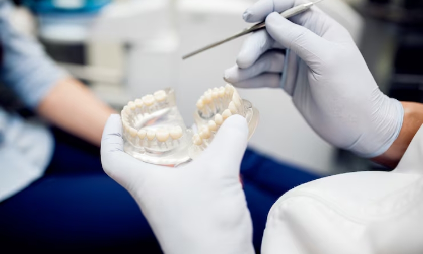 Non-Metal Crowns in Sugar Land, TX